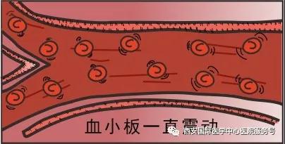 血小板是正常值的三倍？專家提醒小心血栓和出血！