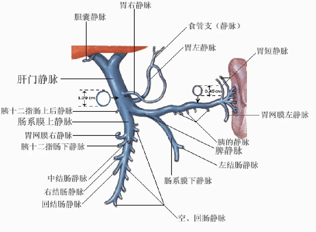 反復嘔血、黑便怎么辦？TIPS手術(shù)能解決