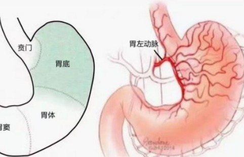 不開刀不吃藥不餓肚子，微創(chuàng)介入減肥靠譜嗎？